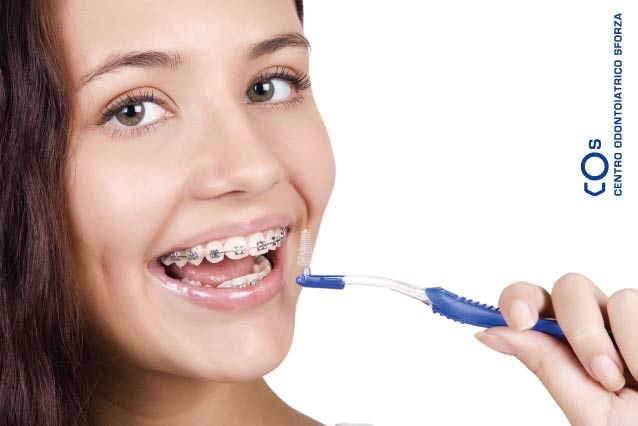 Igiene orale con l'apparecchio dentale. È facile se sai come fare!